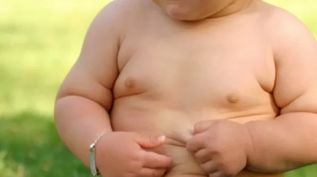 Obesitas