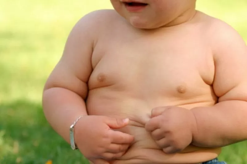 Obesitas