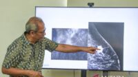 Eka-Hospital-Beri-Edukasi-Penanganan-Kanker-Payudara-06102025-gp-3